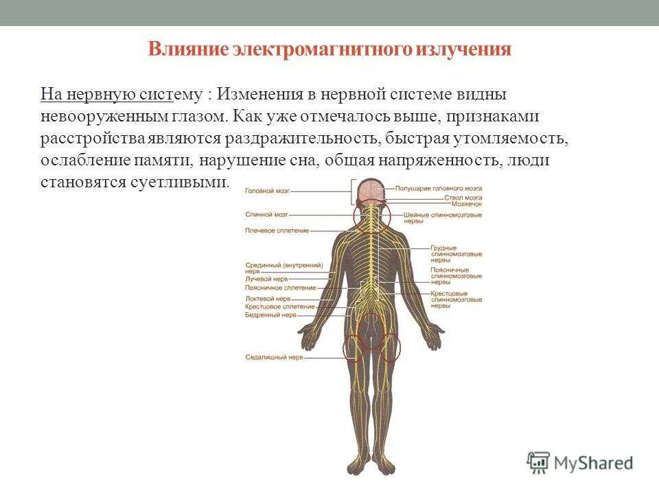 Электромагнитное излучение: виды, источники, влияние на организм, защита