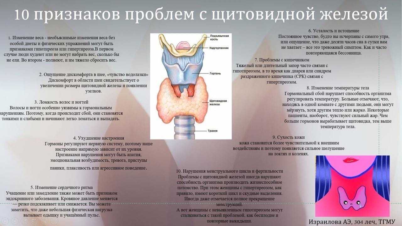Зоб щитовидной железы: классификация, симптомы и лечение зоба щитовидки на шее у человека | клиники «евроонко»