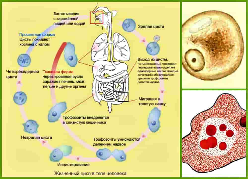 Амебиаз: кишечная и внекишечная форма инфекции