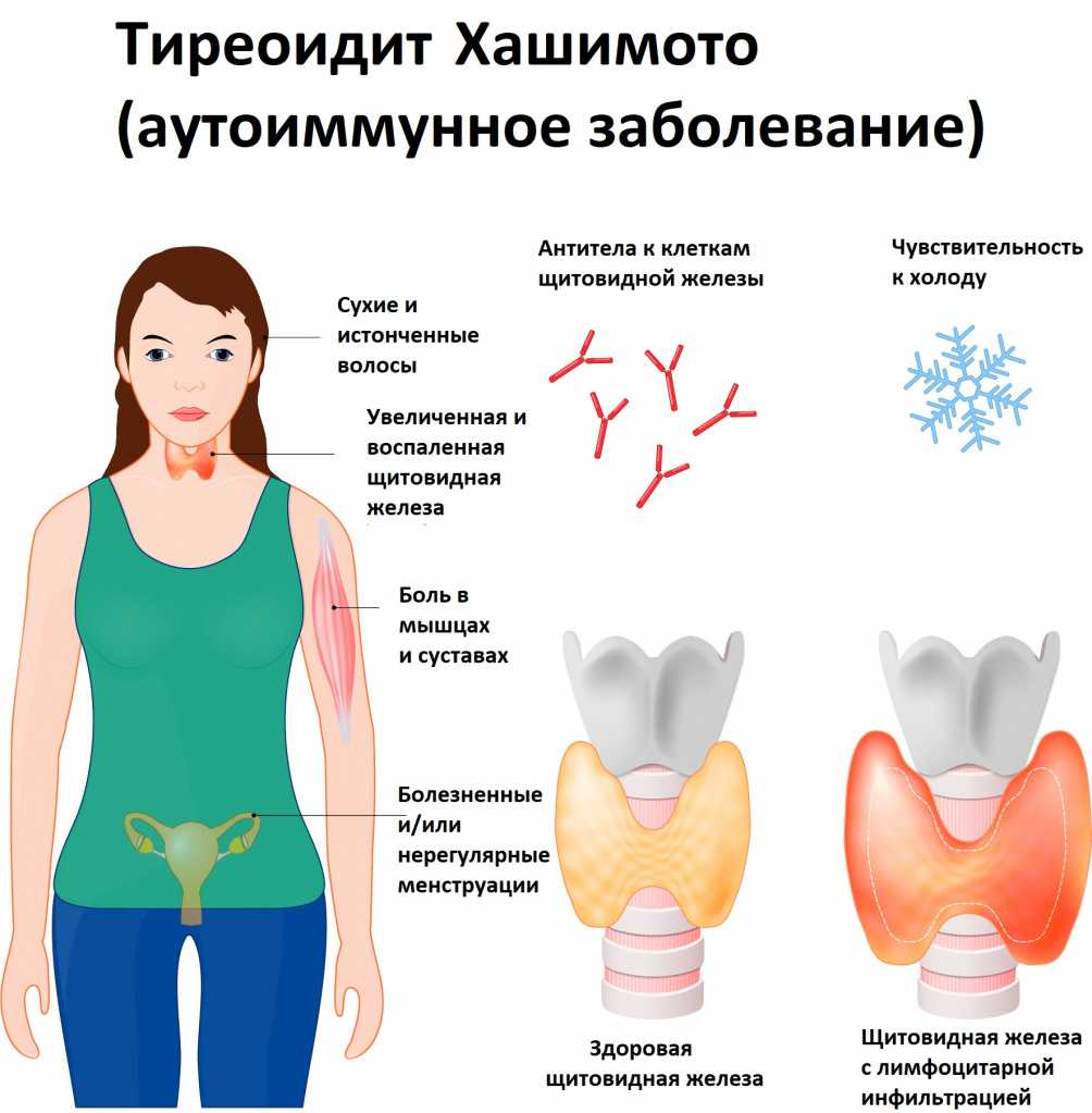 Чем опасно заболевание щитовидной железы?